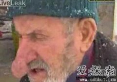 世界上鼻子最大的人