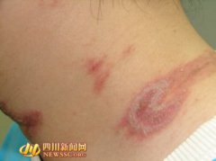 隱翅蟲喜歡什么環境