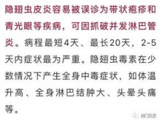 隱翅蟲爬過后會留疤嗎