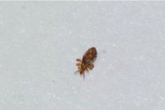 虱子卵幾天變成虱子