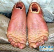 超惡心的空手指是什么，現實生活中是并不存在