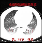 墜積效應是什么意思