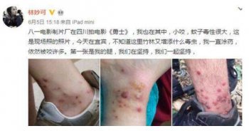 林妙可被毒蟲咬傷照片，觸目驚心腳腕全是傷痕