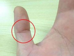 大拇指有佛眼的女人什么命，有佛眼的人都有福
