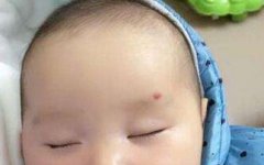 神仙轉世胎記的位置，額頭、手臂、前胸、腹部和肚臍周圍