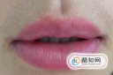 女生的小胡子怎么去掉，歐陽娜娜如何去唇毛