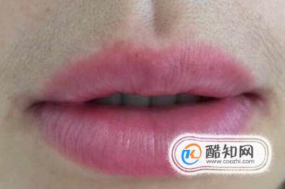 女生的小胡子怎么去掉，歐陽娜娜如何去唇毛