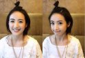 林依晨為什么不能生育